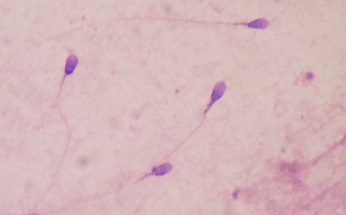 Fertility Investigations Sperm Analysis